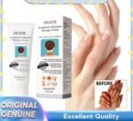 EELHOE Acanthosis Nigricans Therapy Cream Neck Arm Knee Joint Underarm Whitening 50g